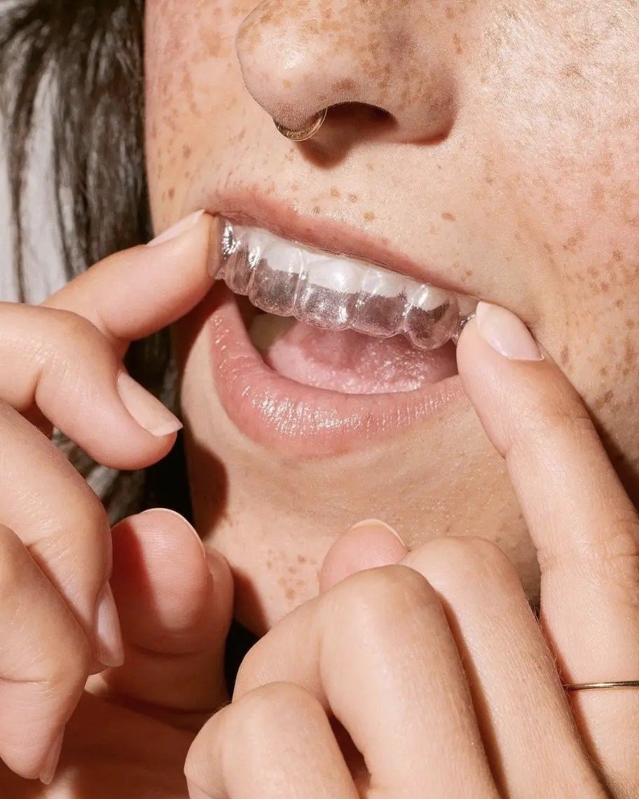 Byte At-Home Aligners